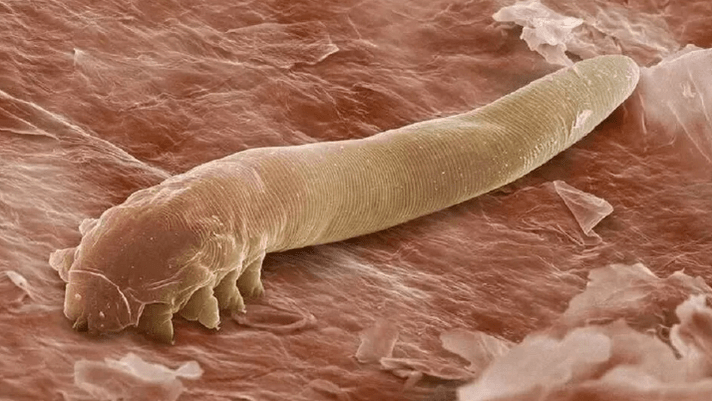 Parasiten im menschlichen Körper