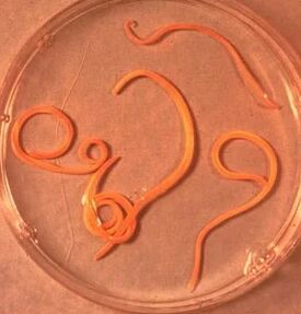 Parasiten des Mannes Ascarid