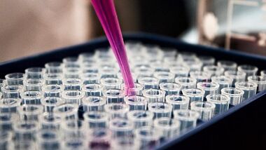 wie man Tests zur Erkennung von Parasiten im Körper macht